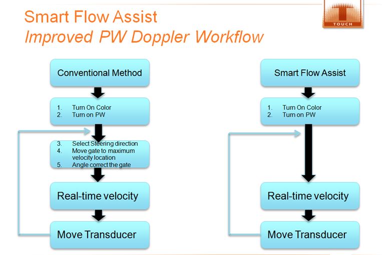 clinical workflows in vascular ultrasound diagram showing reduced steps